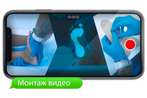 Коммерческое рекламное видео 2019 Медицина