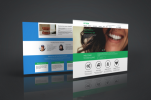 Biteon dental template