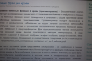 лабораторная диагностика -белковые фракции