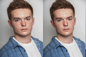 Удаление дефектов на лице