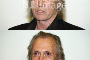 Удаление вoодяного знака