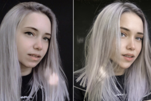 Ретушь и пластика лица