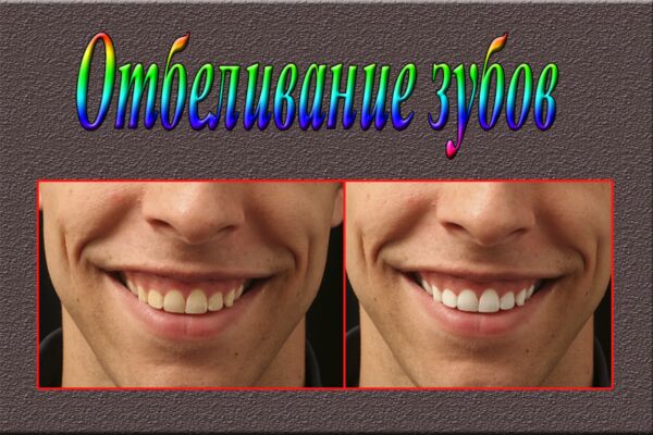 img4074776.png
