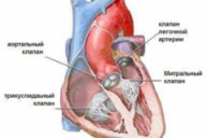 Трикуспидальная регургитация