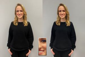 ретуш девушки