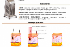 Сайт лазерной эпиляции