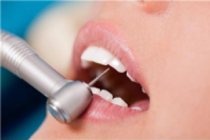 Лечение кариеса