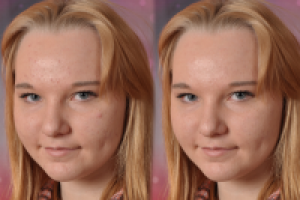 Коррекция несовершенств