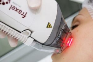 Fraxel: лазерное омоложение