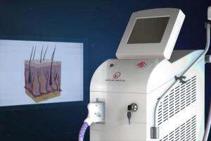 3D ролик-презентация "Косметологический аппарат"