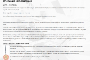 Статья на тему Имплантации зубов