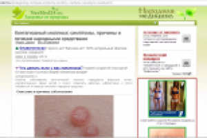 Контагиозный моллюск