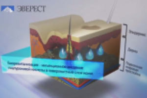 Эверест (омоложение)