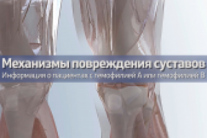 Механизмы повреждения суставов