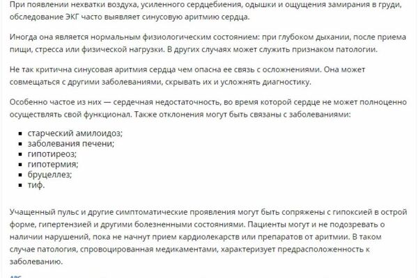 Синусовая аритмия