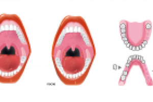 Отрисовка полости рта для стоматологии