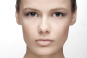 алмазный пилинг. Косметология