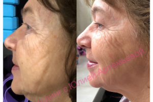 Результат за 3 недели!