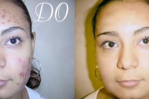 Ретуширование