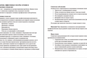 Пять причин отека ног