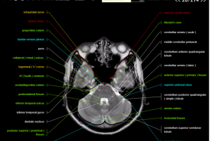 Сайт по анатомии