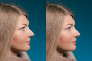 Ретушь портрета