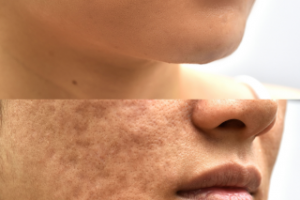 Ретушь лица