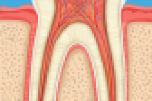 Зуб в разрезе (совместно с Create&Promote)