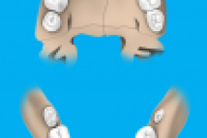 Молочные зубы (совместно с Create&Promote)