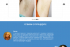 Лендинг эпиляция