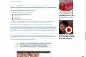 Врожденная и приобретенная вальгусная деформация стопы