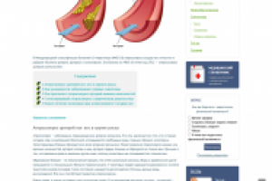 Стенозирующий атеросклероз сосудов нижних конечностей