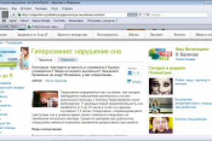 Гиперсомния: нарушение сна