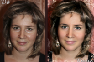 Ретушь кожи лица любительского фото