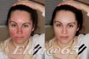 Ретушь фото.