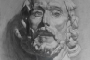 Гипсовая постановка