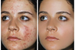 Ретуши лица