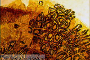 МИКРО фото 2