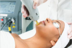 Лазерная эпиляция