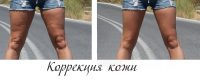 Коррекция кожи