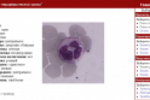 Справочная система нормальные клетки периферической крови