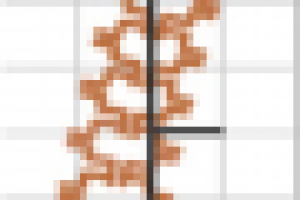 Виды искривления позвоночника.