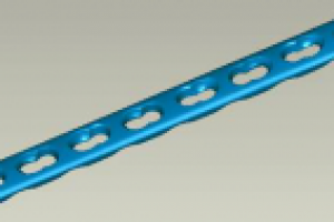 импланты медицина