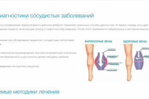 Флебология