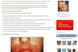 Статья медицинской тематики