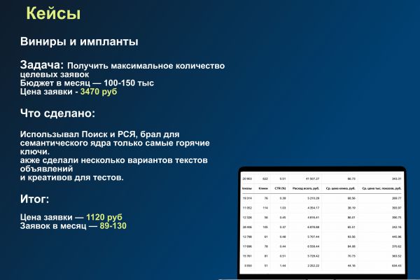 Продвижение в Яндекс Директ "Виниры и импланты"