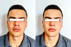 Улучшение качества изображения