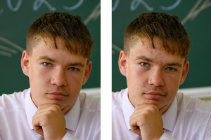 Чистка лица