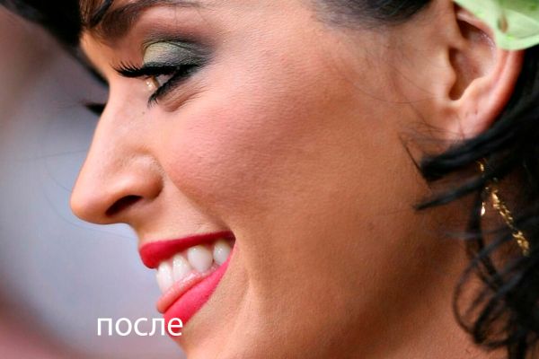 ретушь фото, чистка лица