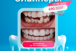 Баннеры для стоматолгии